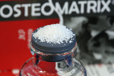 Остеоматрикс крошка (~0,25-1,0 мм)