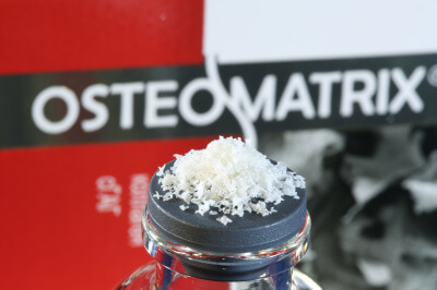 Остеоматрикс чипсы (~1,0-2,0 мм)